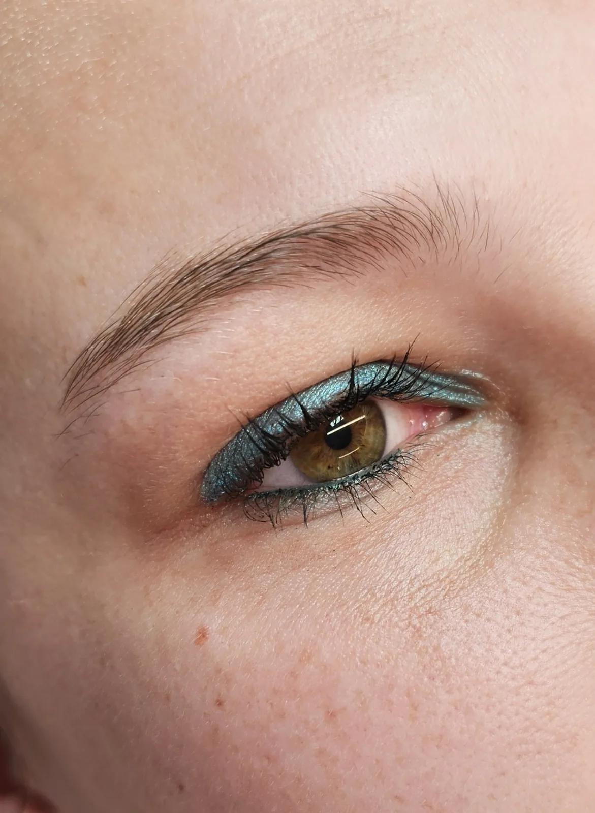 Browlift · avant et après