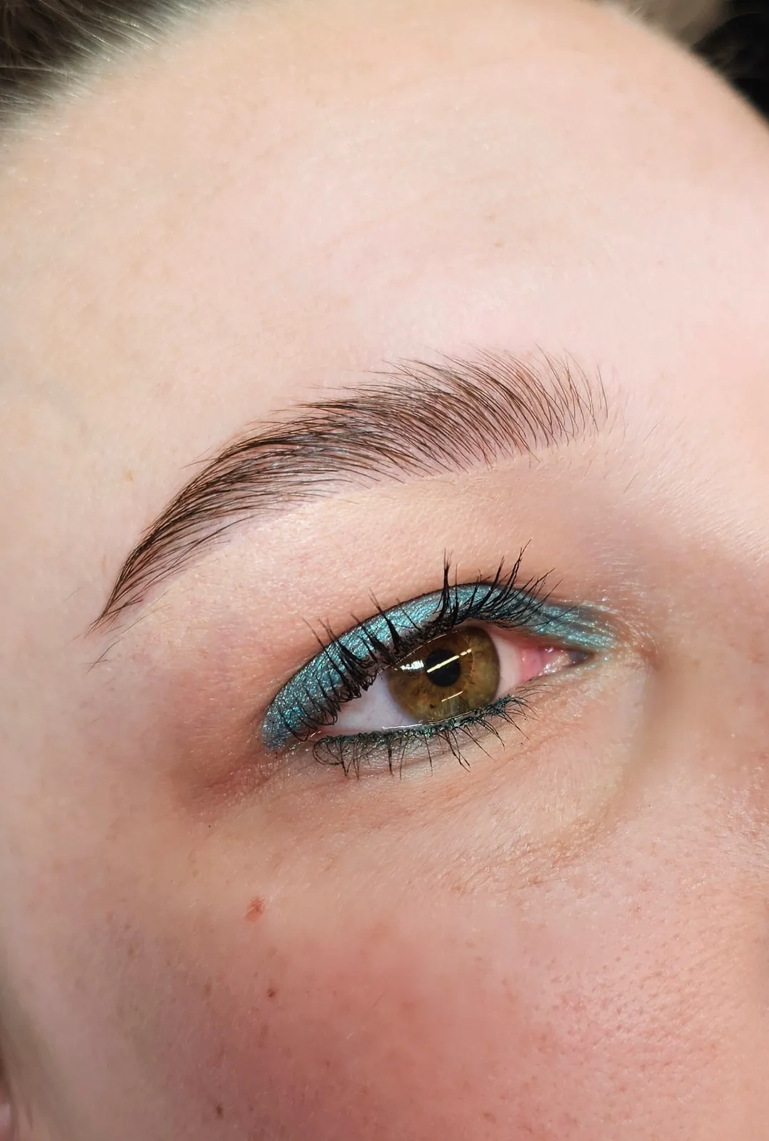 Browlift · avant et après